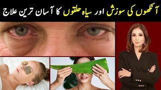 Easy Remedies for Dark Circles and Eyes Swelling | Dr Sahar Chawla