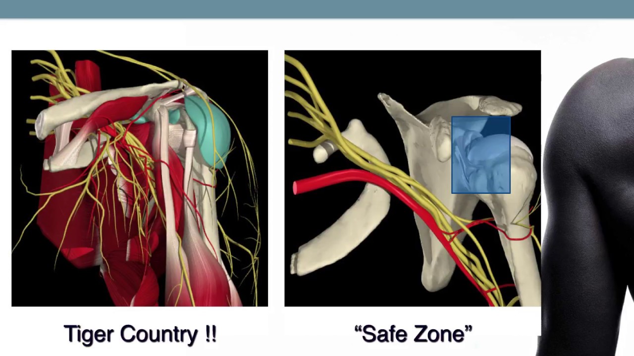 Tips For Basic Shoulder Arthroscopy Part 2- Diagnostic Routine - YouTube