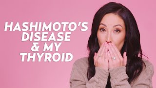 How My Hashimotos Disease Affects My Appearance (Hypothyroid Symptoms) | Skincare with @Susan Yara