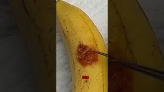 Banana in needles Emergency fruit surgery😂 #goodland #Fruitsurgery #trending #shortsvideo