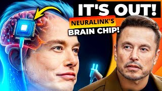 Elon Musk's Brain Chip First Human Trial SHOCKS Synchron!