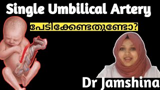 What is Single Umbilical Artery?Should I be Worried about my babies umbilical cord ?SUA Dr Jamshina