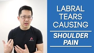 Shoulder pain from labral tears? Is the labrum really the problem?