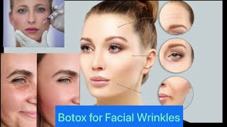 Botox # dentist#dr.Alka khade#Muscle spasm#Wrinkles.