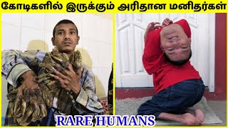 விசித்திரமான மனிதர்கள் | Rare Humans That Are One In A Million in Tamil | TAMIL AMAZING FACTS