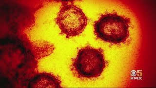 San Mateo County Health Officer Criticizes State COVID-19 Response