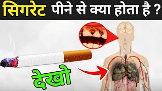 जानिए सिगरेट पीने से क्या होता है ? | How Cigarettes Affect Your Body