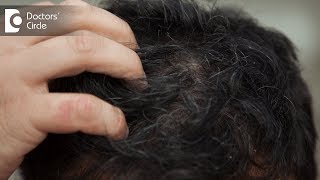 Causes of greying of hair in early teens and how to manage it - Dr. Rasya Dixit