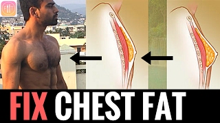 How to get rid of Man Boobs? Workout and Diet Tips.
