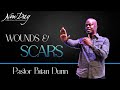 Wounds & Scars - Part 1 | Pastor Brian Dunn