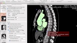 Generating 3D models using Osirix