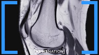 Study: Torn ACL can heal itself without surgery | NewsNation Now