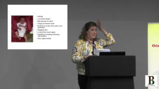 Vascular EDS Conference 2017: VEDS: A Parent's Perspective by Victoria Whatton