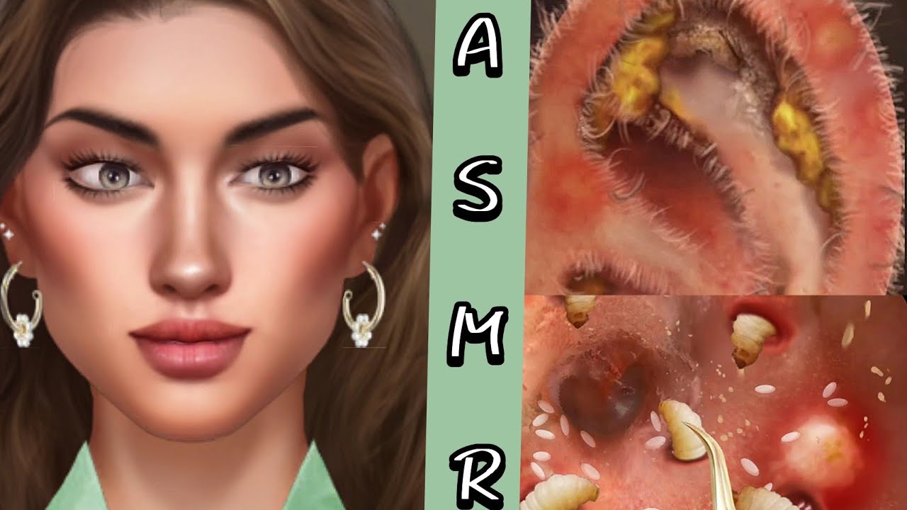 ASMR EAR CLEANING ANIMATION - YouTube