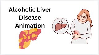 An Animated Guide to Alcoholic Liver Disease: What You Should Know