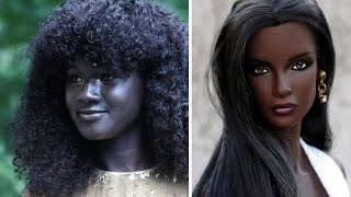 10 Menschen mit extrem seltener Hautfarbe