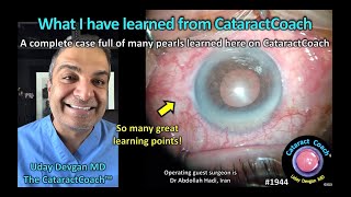 CataractCoach™ 1944: What I have learned from CataractCoach