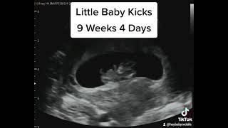 Baby Kicks on Ultrasound at 9 Weeks 4 Days Pregnant