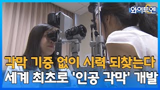 [클립본] 세계 첫 '인공 각막' 상용화 임박  ㅣ 와이투엔 [67회] /YTN2