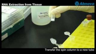 RNA Extraction from Tissue