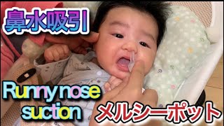 赤ちゃん 鼻水吸引 メルシーポット 3ヶ月 Baby Runny nose suction 3months 콧물 흡입 流鼻涕