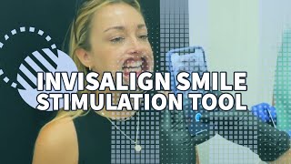 Invisalign Smile Simulation Tool