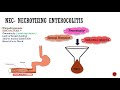 nec necrotizing enterocolitis neonatology series ch 6