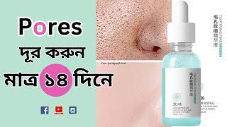 মাত্র ১৪ দিনেই দূর হবে পোরস ।। Invisible Your Pores only 14 day's।। Bangla Review by Tahmina Hossain