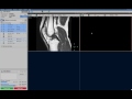 Clinical applications video - SmartExam Knee