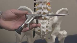 Endoscopic Discectomy By Dr George Rappard