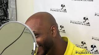 Scalp Micropigmentation  - Willy Style Smp Testimonio