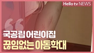 [이슈앤피플]끊임없는 어린이집 아동학대…CCTV도 있는데 왜?