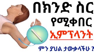 በክንድ ስር የሚቀበር የእርግዝና መከላከያ ኢምፕላንት | ምን ያህል ታውቃላችሁ ? ጥቅሞቹ ፣ ጉዳቶቹ