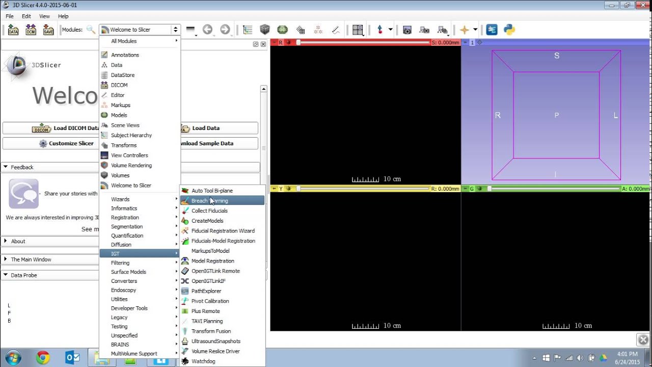 Let S Code 1 Setting Up Python Debugging In Slicer Youtube