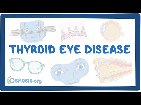 Why does hyperthyroidism cause Proptosis?