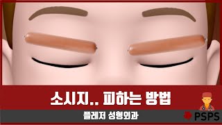 소시지가 걱정되신다면 꼭 보세요! (쌍수 부작용, 눈매교정 by 성형외과 전문의)