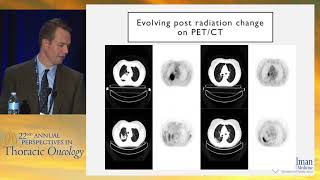 Going beyond positron emission tomography (PET): New imaging approaches