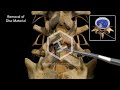 l4 5 posterior interbody fusion