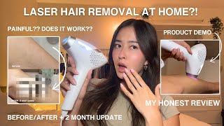 I TRIED LASER HAIR REMOVAL AT HOME! | My experience, product demo, 2 month update ft. DermRays