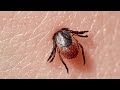 How To Remove a Tick