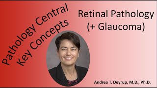 Medical School Pathology: Retinal Pathology (+ Glaucoma)