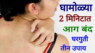 घामोळ्यावर घरगुती उपाय । Fungal infection home remedy । ghamolya gharguti upay । heat rash on body