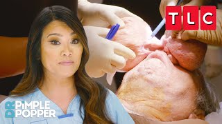 WILDEST Removals Part 3! | Dr. Pimple Popper | TLC