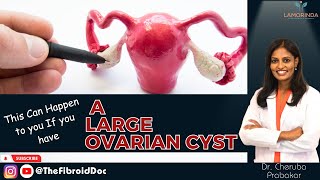 This Can Happen to you If you have A Large Ovarian Cyst - TheFibroidDoc - Dr. Cheruba Prabakar