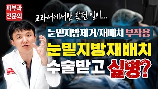 눈밑지방재배치 수술 받고 실명... 눈밑지방제거 부작용 어떤 것들이 있을까요?