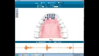 Coarticulation