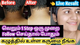 How to remove blackness around neck in tamil/கழுத்தில் உள்ள கருமை நீங்க