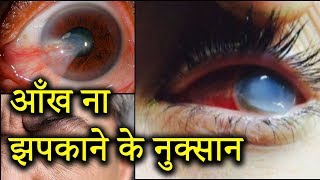 आँख मारने का बहुत बड़ा फायदा भी है  | What Happens When We Don’t Blink