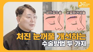 처진  눈꺼풀이 고민이라면? [상안검수술 \u0026 눈썹하거상술]