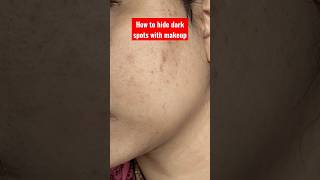 How to hide dark spots with makeup #artist #shorts #makeup #viral #india #video #skincare #darkspots